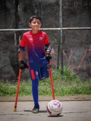 14 jóvenes de fútbol para amputados de Costa Rica necesita apoyo para participar en el Campamento Junior de Polonia